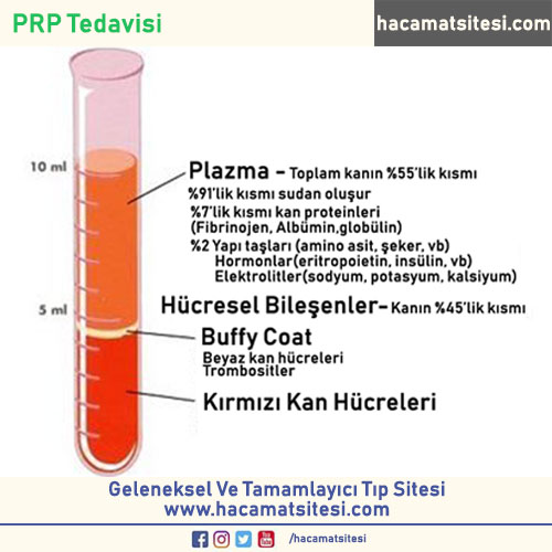 PRP Tedavisi Nasıl Yapılır