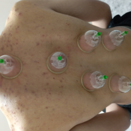 Dr Ahmet CÖMERT, OSMANİYE