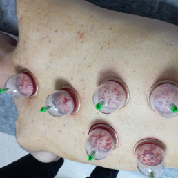 Dr Ahmet CÖMERT, OSMANİYE