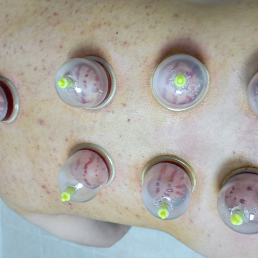 Dr Ahmet CÖMERT, OSMANİYE