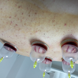 Dr Ahmet CÖMERT, OSMANİYE