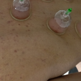 Dr Ahmet CÖMERT, OSMANİYE