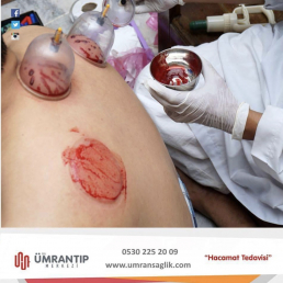 Ümran Tıp Merkezi