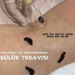 Dr. Beyza AKSU - Kocaeli Tıp Fakültesi